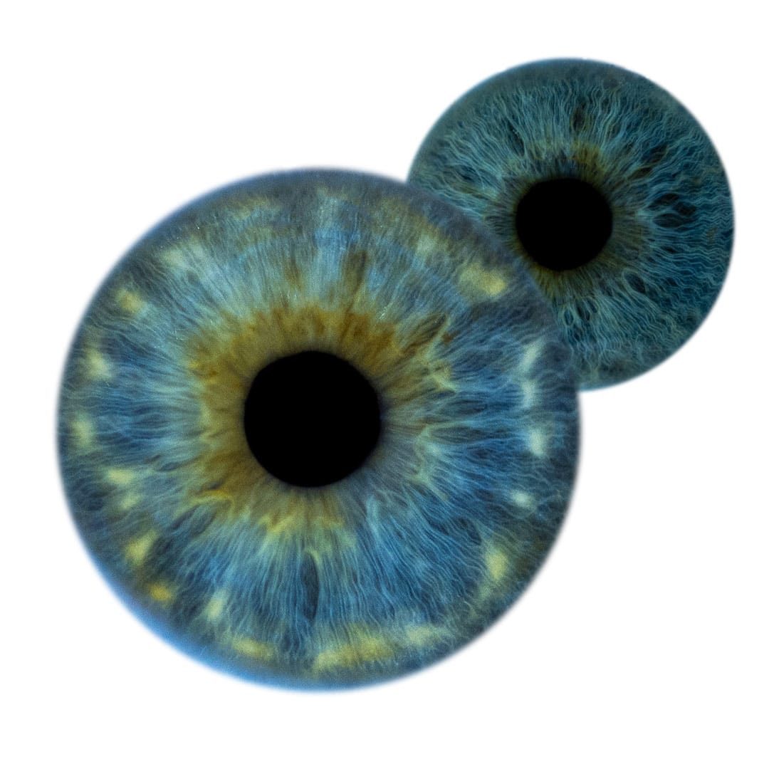 Irisfotografie3